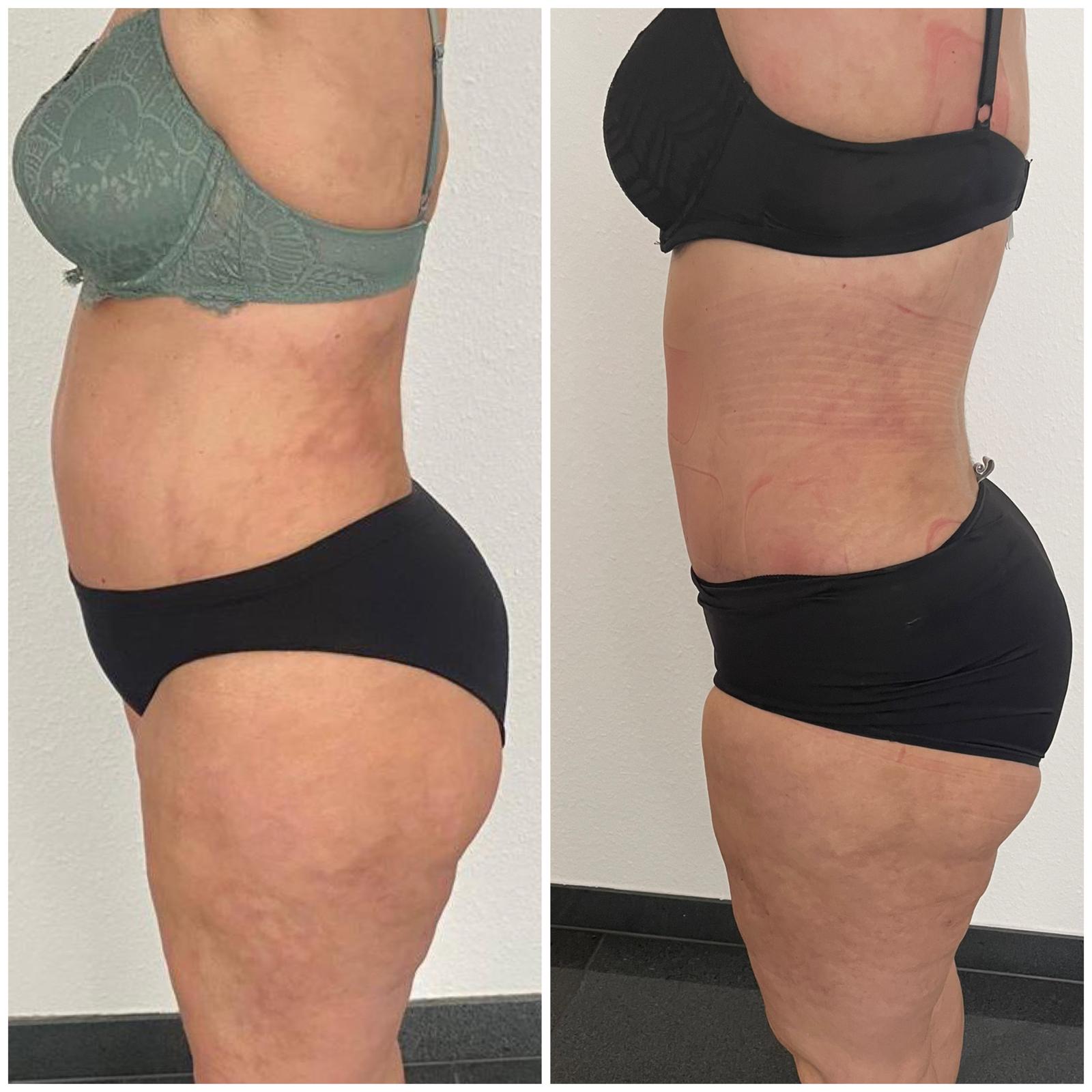bodysecret2 bodysecret2